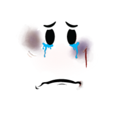 Cry Baby with bruises