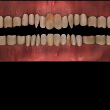A teeth texture for smile accessory