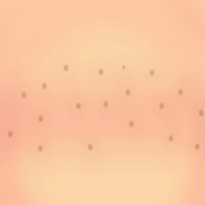 Freckles + Shaded Skin