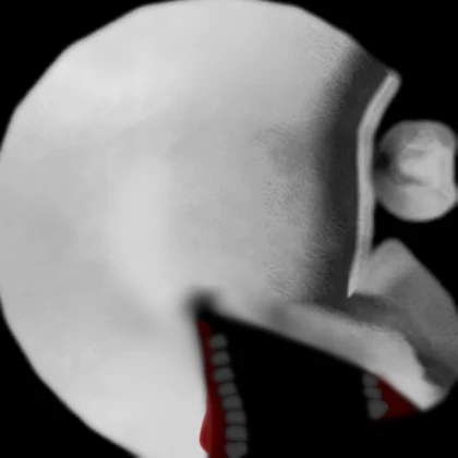 The blind witch (fixed teeth)