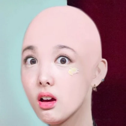 bald nayeon